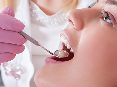 Delgado Dental Group | Botox reg , LANAP reg  and Dental Bridges